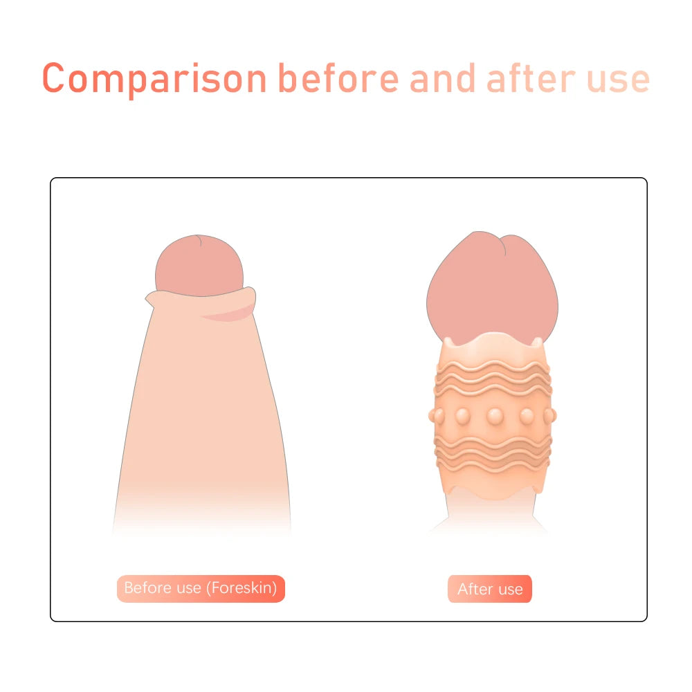 Foreskin Correction Screw Shape Thress Sizes Penis Ring Sex Toys For Men Erection Penis Sleeve Delay Ejaculation